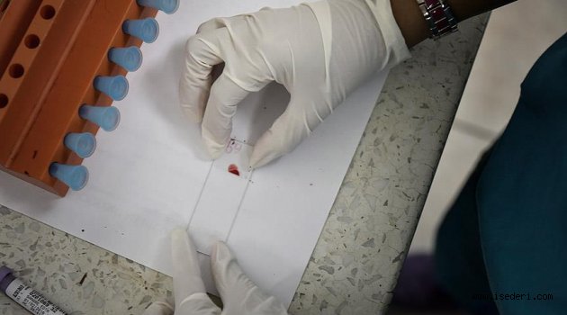 'Zika ile mikrosefali arasında güçlü bağ var'